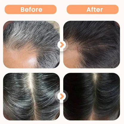 Plant Extract Hair Dye for Gray Hair 200 ml (Pack of 1)